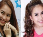Ayu Ting Ting